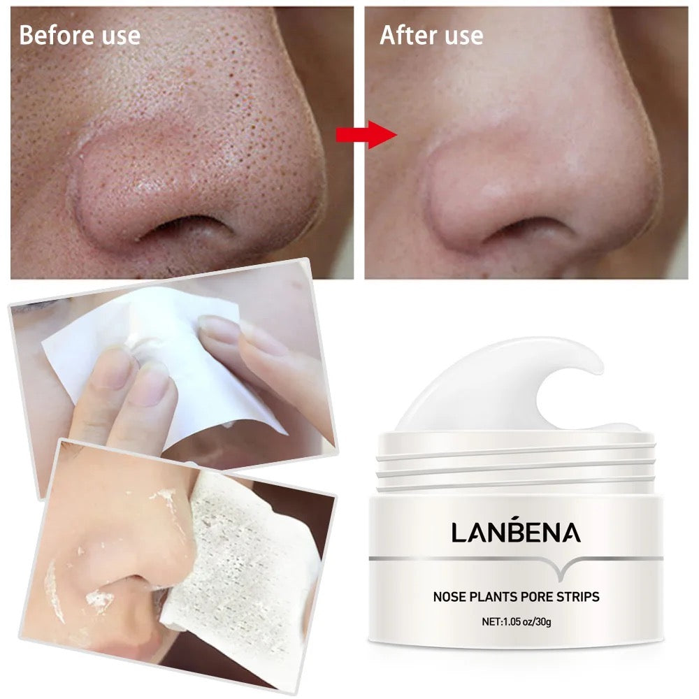 LANBENA | Nose Plants Pore Strips